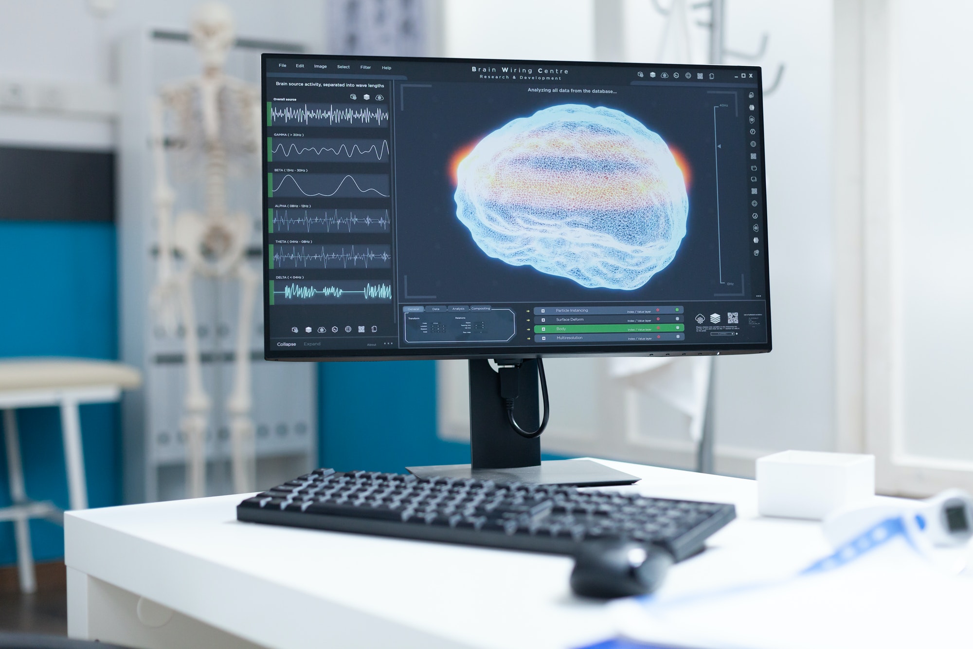 eicu remote monitoring