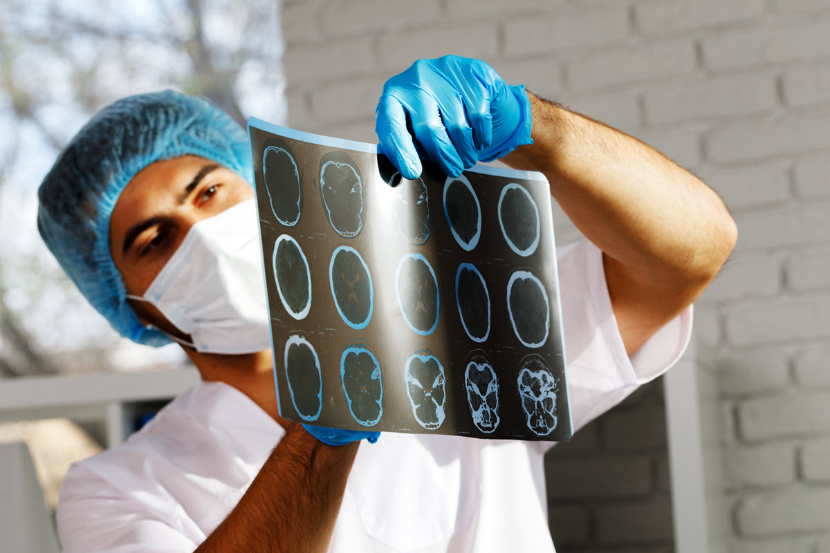 The Benefits of Teleneurology